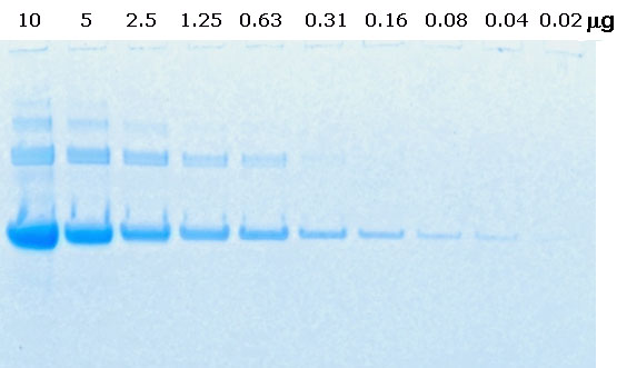 Sds+page+gel+staining